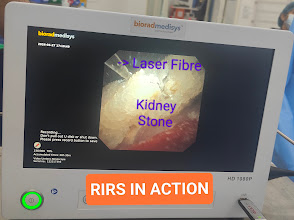 Urology on TinTorch Lists